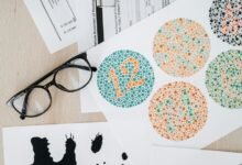 hyper node vision 794