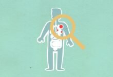 why kialodenzydaisis kills deserves study