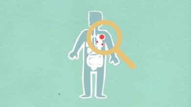 why kialodenzydaisis kills deserves study
