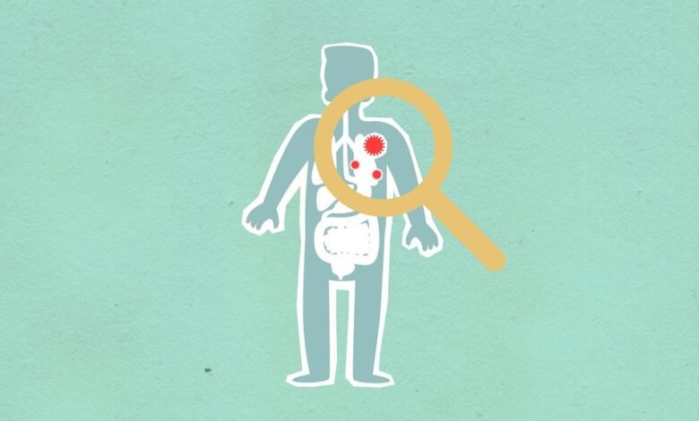 why kialodenzydaisis kills deserves study